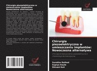 bokomslag Chirurgia piezoelektryczna w umieszczaniu implantów: Nowoczesna alternatywa