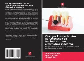 bokomslag Cirurgia Piezoeléctrica na Colocação de Implantes: Uma alternativa moderna