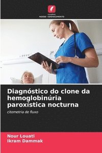 bokomslag Diagnóstico do clone da hemoglobinúria paroxística nocturna