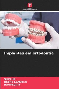 bokomslag Implantes em ortodontia
