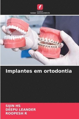 bokomslag Implantes em ortodontia