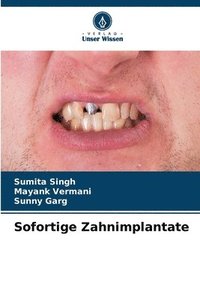 bokomslag Sofortige Zahnimplantate