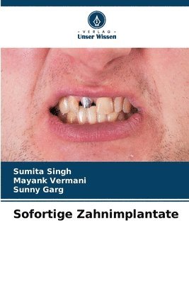bokomslag Sofortige Zahnimplantate