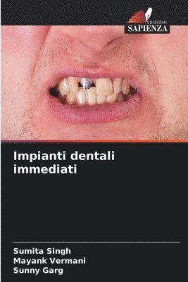 bokomslag Impianti dentali immediati
