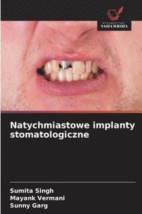 bokomslag Natychmiastowe implanty stomatologiczne
