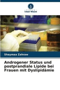 bokomslag Androgener Status und postprandiale Lipide bei Frauen mit Dyslipidämie