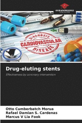 Otto Cumberbatch Morúa, Rafael Damián S Cárdenas, Marcus V Lia Fook, Rafael Damián S. Cárdenas, Mar S. Cárdenas, Rafael Damián - Drug-eluting stents, Häftad
