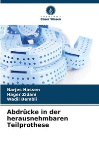 bokomslag Abdrücke in der herausnehmbaren Teilprothese