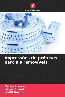 bokomslag Impressões de próteses parciais removíveis