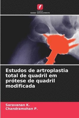 bokomslag Estudos de artroplastia total de quadril em prótese de quadril modificada