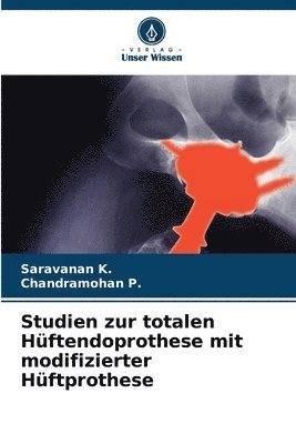 Saravanan K, Chandramohan P, Saravanan K., Chandramohan P. - Studien zur totalen Hüftendoprothese mit modifizierter Hüftprothese, Häftad