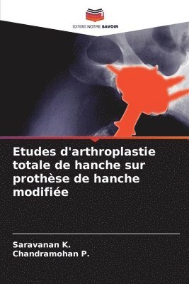 Saravanan K, Chandramohan P, Saravanan K., Chandramohan P. - Etudes d'arthroplastie totale de hanche sur prothèse de hanche modifiée, Häftad