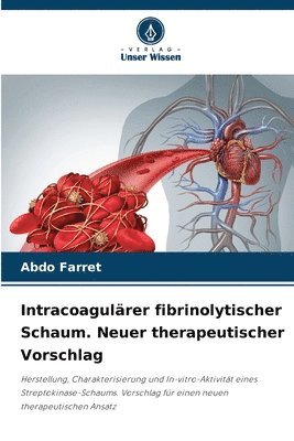 bokomslag Intracoagulärer fibrinolytischer Schaum. Neuer therapeutischer Vorschlag