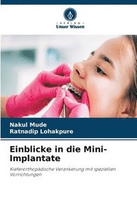 bokomslag Einblicke in die Mini-Implantate