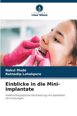 bokomslag Einblicke in die Mini-Implantate