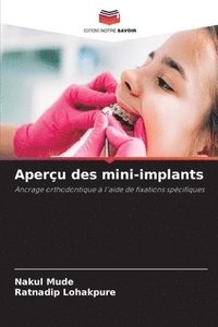 bokomslag Aperçu des mini-implants