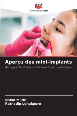 Nakul Mude, Ratnadip Lohakpure - Aperçu des mini-implants, Häftad
