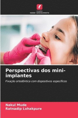 bokomslag Perspectivas dos mini-implantes