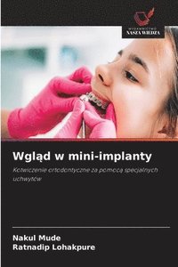 bokomslag Wgl?d w mini-implanty