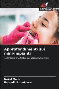 bokomslag Approfondimenti sui mini-impianti