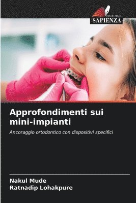 bokomslag Approfondimenti sui mini-impianti