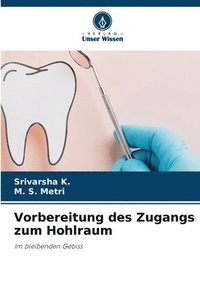 bokomslag Vorbereitung des Zugangs zum Hohlraum