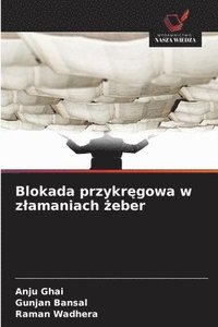 bokomslag Blokada przykr?gowa w zlamaniach ?eber