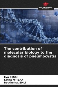 bokomslag The contribution of molecular biology to the diagnosis of pneumocystis