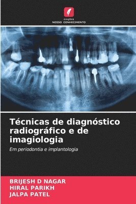 Brijesh D. Nagar, Hiral Parikh, BRIJESH D NAGAR, Brijesh D Nagar, Jalpa Patel - Técnicas de diagnóstico radiográfico e de imagiologia, Häftad