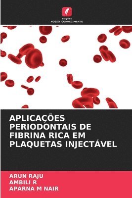 Arun Raju, Ambili R, Aparna M Nair - Aplicações Periodontais de Fibrina Rica Em Plaquetas Injectável, Häftad