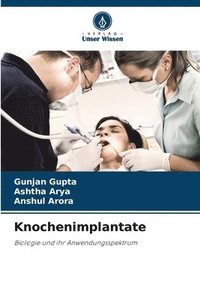 bokomslag Knochenimplantate