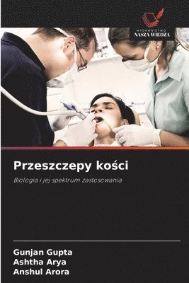 Gunjan Gupta, Ashtha Arya, Anshul Arora - Przeszczepy kości, Häftad