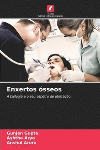bokomslag Enxertos ósseos