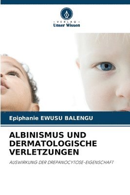 Epiphanie Ewusu Balengu, Epiphanie EWUSU BALENGU - Albinismus Und Dermatologische Verletzungen, Häftad