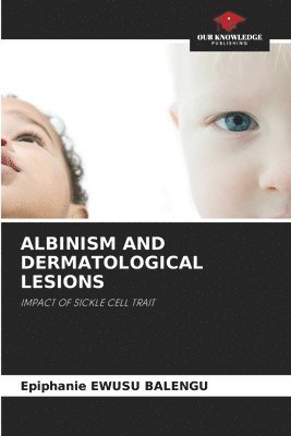 bokomslag ALBINISM AND DERMATOLOGICAL LESIONS