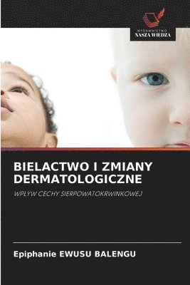 Epiphanie Ewusu Balengu, Epiphanie EWUSU BALENGU - Bielactwo I Zmiany Dermatologiczne, Häftad