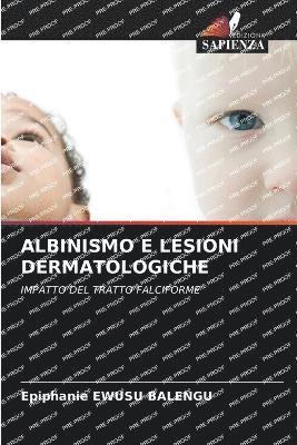 Epiphanie Ewusu Balengu, Epiphanie EWUSU BALENGU - Albinismo E Lesioni Dermatologiche, Häftad