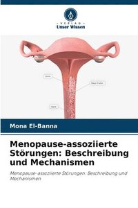 bokomslag Menopause-assoziierte Störungen