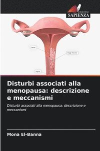 bokomslag Disturbi associati alla menopausa: descrizione e meccanismi