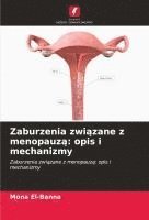 bokomslag Zaburzenia zwi?zane z menopauz?: opis i mechanizmy