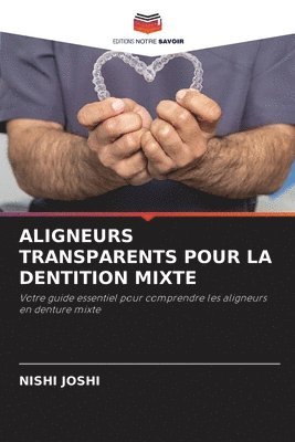 Nishi Joshi, NISHI JOSHI - Aligneurs Transparents Pour La Dentition Mixte, Häftad