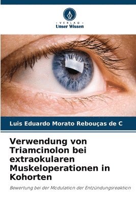 bokomslag Verwendung von Triamcinolon bei extraokularen Muskeloperationen in Kohorten