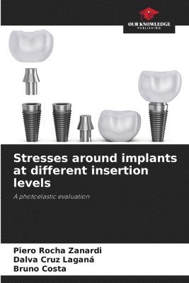 bokomslag Stresses around implants at different insertion levels