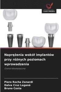bokomslag Napr??enia wokól implantów przy ró?nych poziomach wprowadzenia