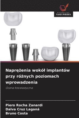 bokomslag Napr??enia wokól implantów przy ró?nych poziomach wprowadzenia