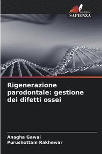bokomslag Rigenerazione parodontale: gestione dei difetti ossei