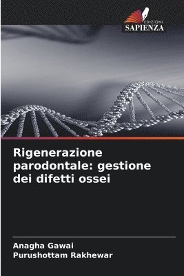 bokomslag Rigenerazione parodontale: gestione dei difetti ossei