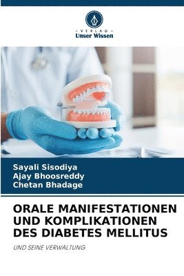 bokomslag Orale Manifestationen Und Komplikationen Des Diabetes Mellitus