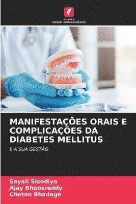 Manifestações Orais E Complicações Da Diabetes Mellitus