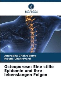 bokomslag Osteoporose: Eine stille Epidemie und ihre lebenslangen Folgen